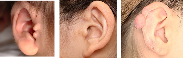 顔・目元・耳のお悩み